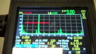 Epoch XT Quick Shear Wave Calibration [upl. by Wendall]