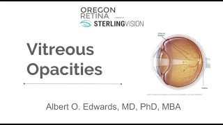 Part 1 Vitreous Anatomy [upl. by Eenyaj596]