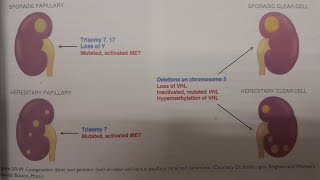 Renal Cell Carcinoma  SPECIAL PATHOLOGY [upl. by Haraf]