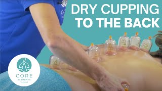 Clinical Dry Cupping to the Back including the spinous processes [upl. by Alderman]