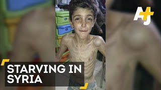 Children Are Starving To Death In Madaya Syria [upl. by Eetak]