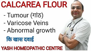 Calcarea Flour explained  Dose and symptoms  Brain tumour  varicose veins [upl. by Sset]