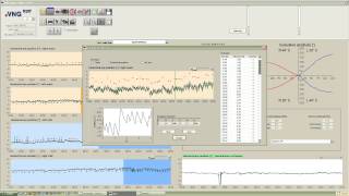 eVNG Caloric Settings [upl. by Guod]