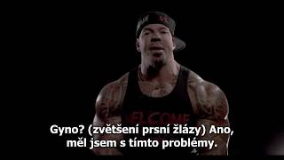 ANABOLICKÉ STEROIDY  vedlejší účinky Rich Piana [upl. by Kial]