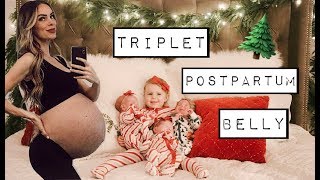 TRIPLET POSTPARTUM BELLY  CARAS POST PREGNANCY LIFE  CHATWIN SIBLING PAJAMA PARTY [upl. by Aled]