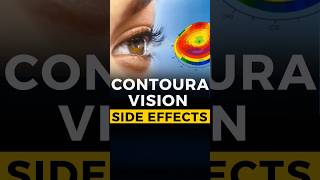 Contoura Vision SIDE EFFECTS [upl. by Stilla]