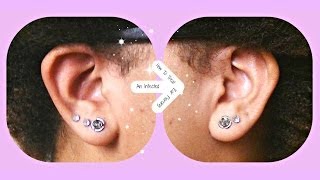 How ToTreat An Infected Ear Piercing [upl. by Alekat]