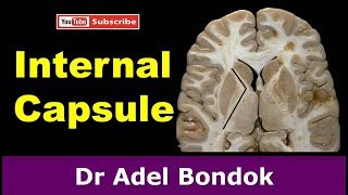 Internal Capsule Dr Adel Bondok [upl. by Woodward920]