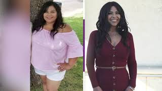 Considering Weight Loss Surgery [upl. by Nrevel]