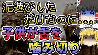 【ゆっくり解説】原因はかすり傷⁉︎致死率50、子供が感染しまくる恐ろしすぎる感染症【破傷風】 [upl. by Rorry]