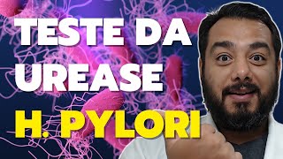 Teste de urease positivo para H pylori o que significa como é feito o exame  Dr Victor Proença [upl. by Notlek]