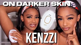 HOME LASER HAIR REMOVER DEMO amp REVIEW Kenzzi on darker skin Is it safe [upl. by Barbaraanne]