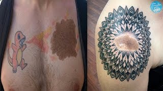 Genius Birthmark Cover Up Tattoo Ideas Ever [upl. by Fiorenza]