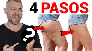 Como Eliminar La CELULITIS De Las Piernas en UNA SEMANA [upl. by Brian]