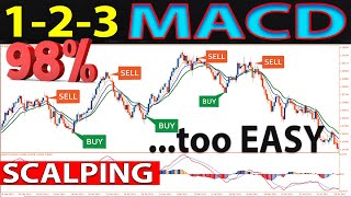 🔴 123 EMAMACD quotSCALPINGquot Strategy  One of The Best Absolute Methods for Trading [upl. by Roselin]