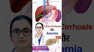 Liver cirrhosis or anemia shorts [upl. by Anitnuahs]