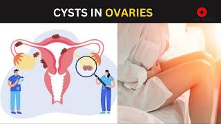 Ovary Ultrasound Reporting  Ovarian Diseases Scan Reports  How To Write USG Report  Pelvic USG [upl. by Akeihsat848]