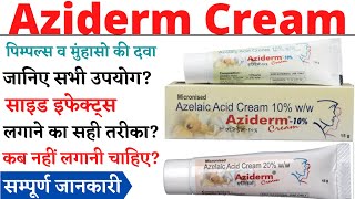 Aziderm Cream Aziderm 10 Cream Aziderm 20 Cream Review in Hindi [upl. by Suchta]