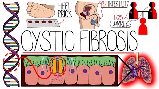 Understanding Cystic Fibrosis Includes Pathophysiology amp Diagnosis [upl. by Notselrahc646]