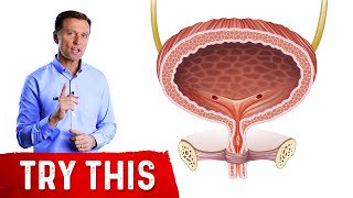 The Best Bladder Remedy I Know [upl. by Wayne]