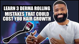 3 Derma Rolling MISTAKES that could cost you hair growth [upl. by Gluck]