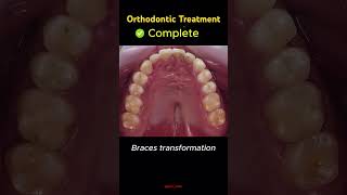 trending dentist dentalclinic orthodontist dental smile braces dentistry shorts yt bds [upl. by Thera660]