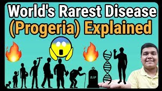 Progeria Syndrome Explained  How it is caused [upl. by Wildermuth818]