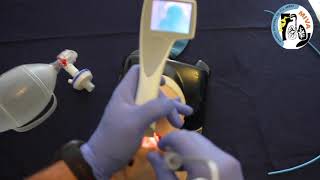 Intubación con Videolaringoscopio IVIEW de Intersurgical [upl. by Zachar]