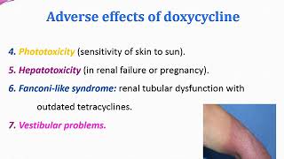 Treatment of sexually transmitted diseases [upl. by Bud132]