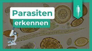 Parasiten Die unsichtbare Bedrohung für Dein Immunsystem [upl. by Nej]