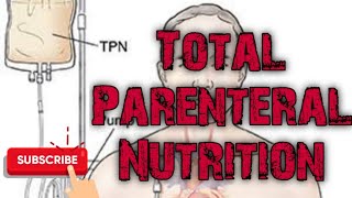 Total Parenteral Nutrition  Hyper alimentation [upl. by Clara]