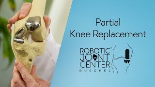 NYC Partial Knee Replacement Surgery  Robotic Joint Center Frederick Buechel Jr MD  Taipei UES [upl. by Andros34]