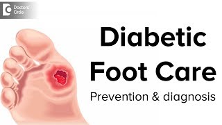 Diabetic Foot Care  Prevention and Diagnosis  Dr Mohan M R [upl. by Aremat]