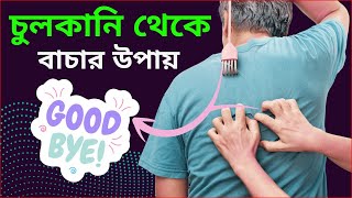 চুলকানি বা এলার্জি রোগের চিকিৎসা  Allergy Treatment HealthCription [upl. by Hairahs]