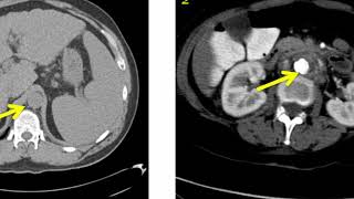 Introduction to Radiology Computed Tomography [upl. by Rosemonde]