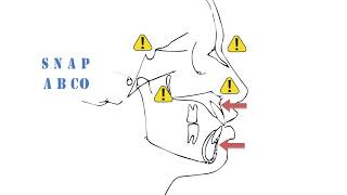 Cephalometrics Part I [upl. by Enorahs]