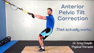 3 Anterior Pelvic Tilt Correction Exercises  Standing Posterior Tilt That Actually Works [upl. by Ahseen569]