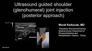 Ultrasound guided shoulder glenohumeral joint injection posterior approach [upl. by Nifled]