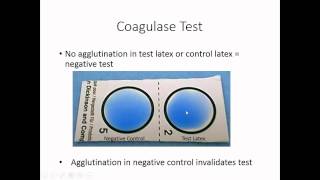 Identification of Staphylococcus [upl. by Yekcor]