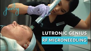 Lutronic Genius RF Microneedling  Juvly Aesthetics [upl. by Roslyn161]