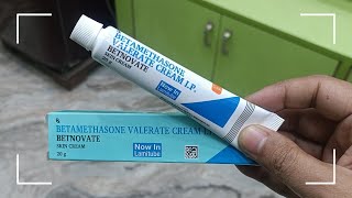 Betamethasone Valerate Cream IP Uses In Hindi  Betnovate Skin Cream In Hindi [upl. by Rehpotsyrk919]