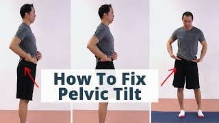 Fix Anterior Posterior or Lateral Pelvic Tilt via Awareness amp Control [upl. by Nednil]