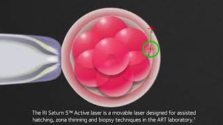 RI Saturn 5™ Active laser [upl. by Missi]