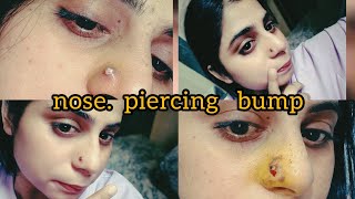 How to recover nose piercing bump 👃 100 profit [upl. by Llennahs]