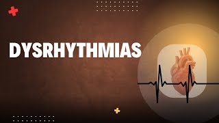 ArrhythmiasDysrhythmias [upl. by Hardden]