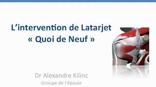 Intervention de Latarjet Butée osseuse pour luxation antérieure de lépaule [upl. by Arreis]