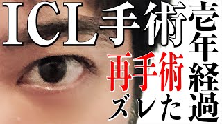 【強度近視乱視】ICLの手術して１年経ったから言いたいこと喋る【回転して再手術】【極薄角膜レーシック不適合者】ICL 近視矯正手術 [upl. by Nesilla459]