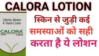 Calamine lotion ।CALORA lotion review in Hindi [upl. by Okramed]