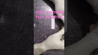 VDRL ANTIGEN TEST POSITIVE medicalcollegestudents youtubeshorts ytshorts lab [upl. by Virgina858]