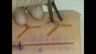 24 Three point junction suture [upl. by Nolyag281]